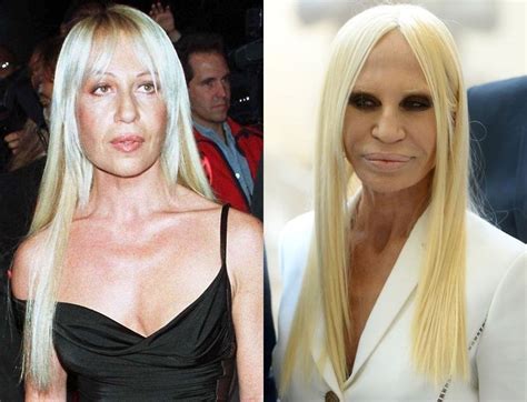 versace donatella before surgery|Donatella Versace without make up.